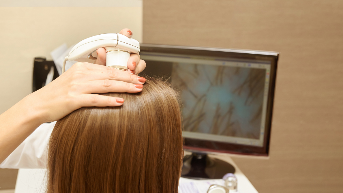 Woman Check Head Hair in Clinic.